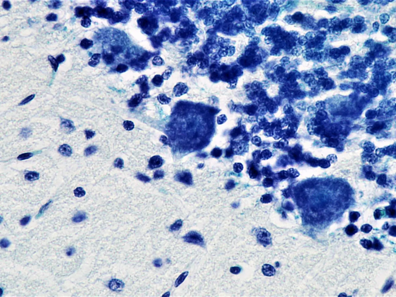 The image shows a formalin/PFA-fixed paraffin-embedded section of an anti-pfa1 antibody [epr22828]...