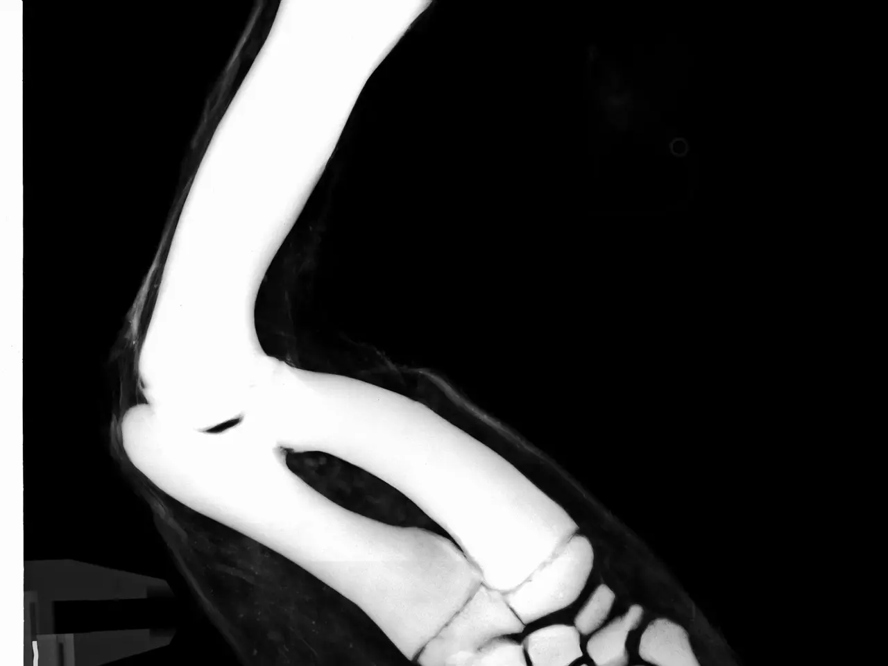 The image shows an x-ray of a human leg with a fracture in the ankle, providing a detailed view of...