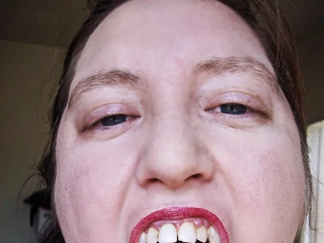 In the image there is a woman, she is opening her mouth widely and the background of the woman is...