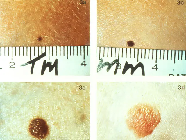 The image shows a close up of a person's skin with a ruler next to it, and a collage of four...