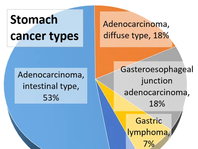 The image shows a white background with a pie chart depicting the percentage of stomach cancer...