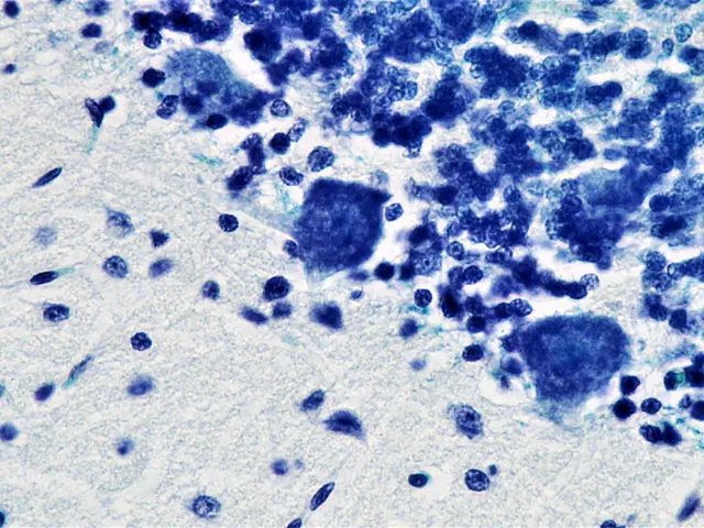 The image shows a formalin/PFA-fixed paraffin-embedded section of an anti-pfa1 antibody [epr22828]...
