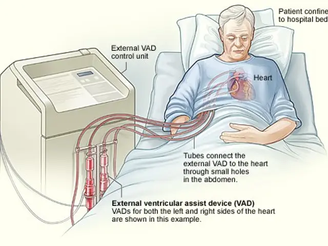 The image shows a man laying in a hospital bed with an external ventricular assist device (VAD)...