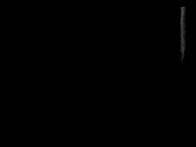 The image shows a black and white MRI scan of a patient's knee, providing a detailed view of the...