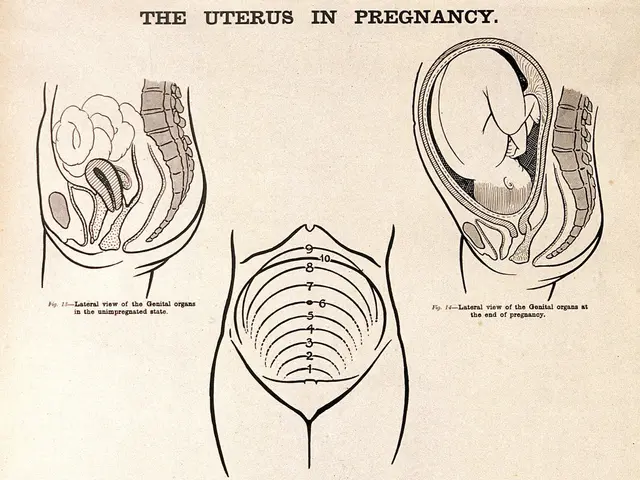 The image shows a paper with pictures and text depicting the anatomy of the uterus in pregnancy....