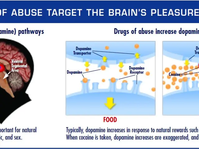 The image shows a poster with a picture of a person's brain on the left side and text at the top...
