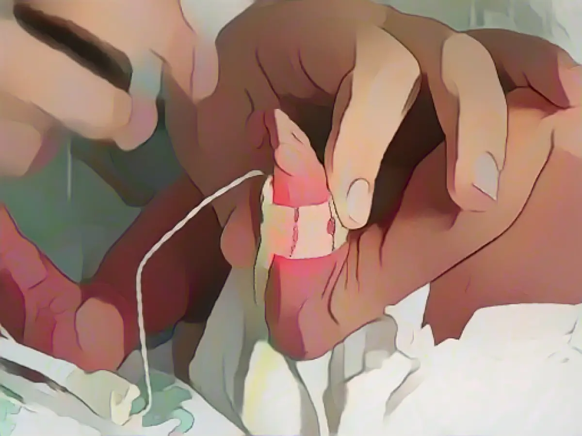 Techniker Krankenkasse: Fewer premature births in Hamburg