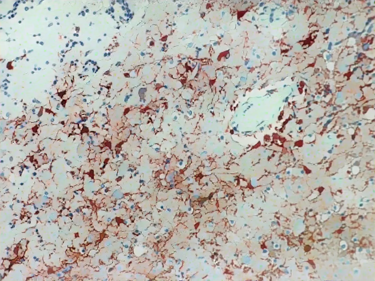 Man infected with Borna virus in Bavaria