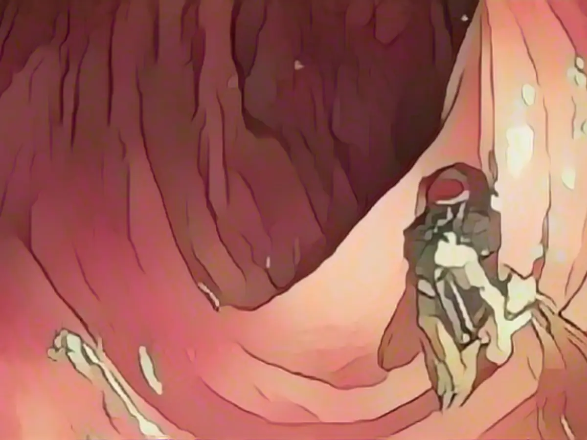 Here a fly buzzes through the large intestine