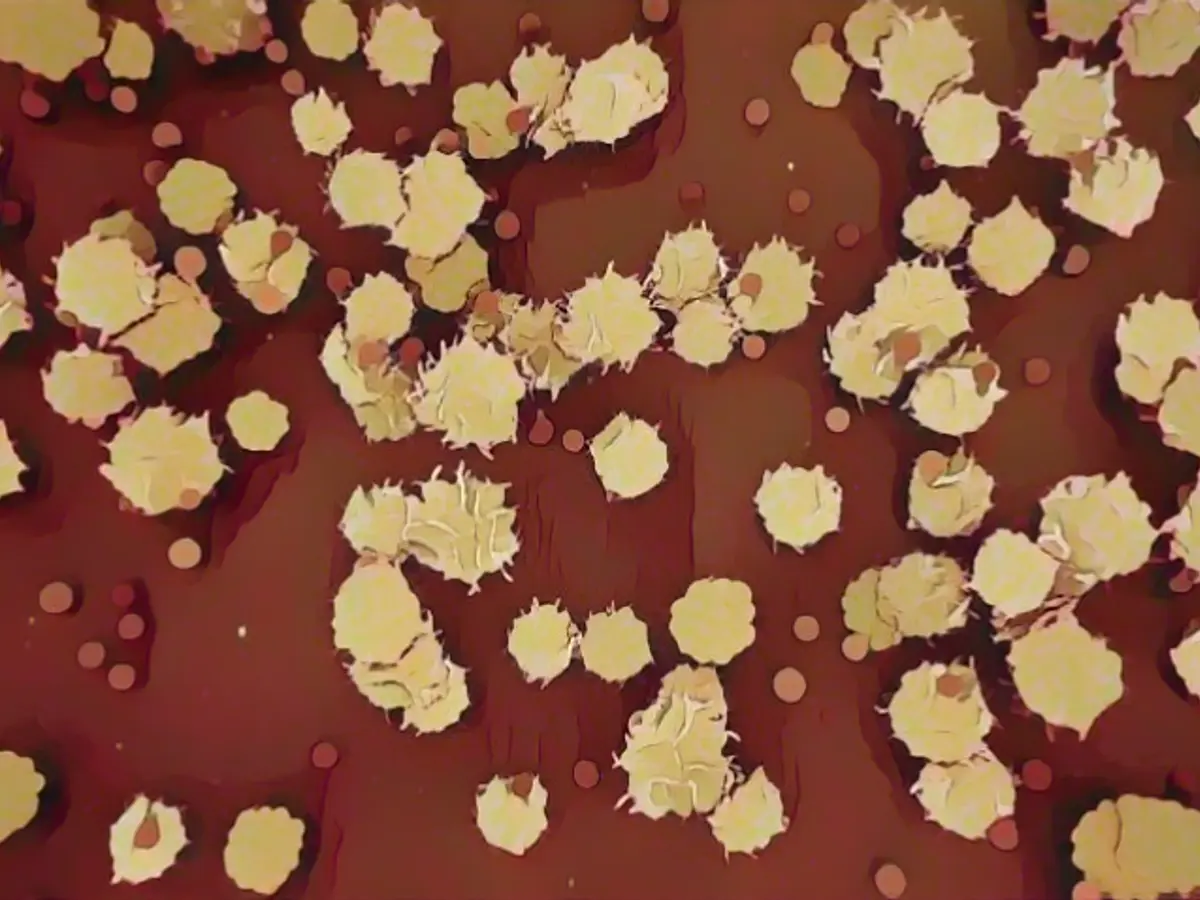 Deaths from monkeypox are rare in the United States. Therefore, it is difficult to confirm them