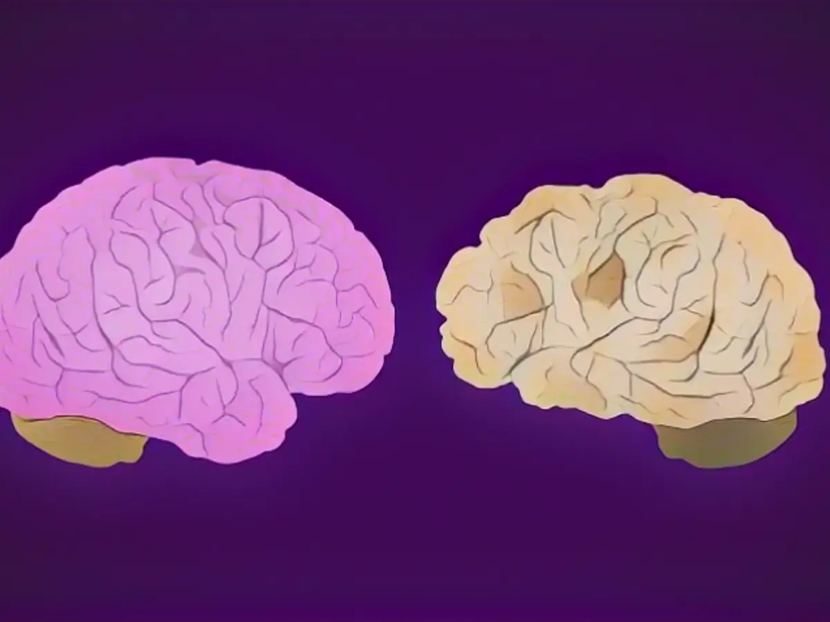 U.S. health officials hope to "transform" Alzheimer's disease research with a $300 million data platform.