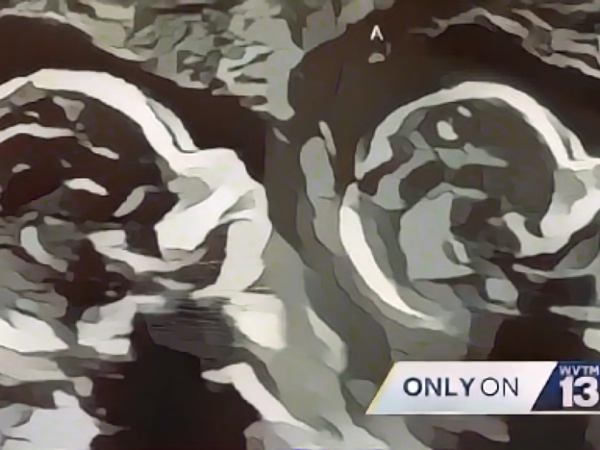 Woman has two wombs and there is a baby in both