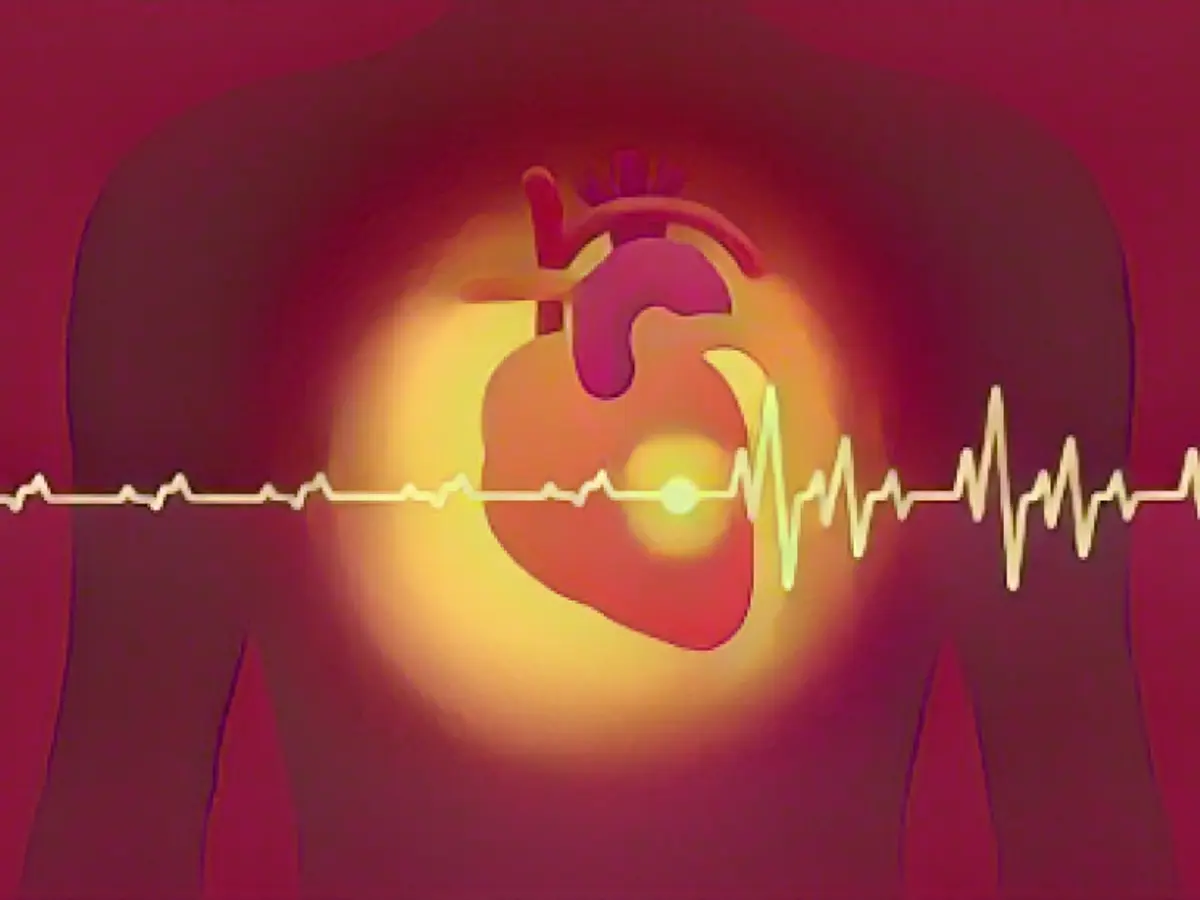 AI can predict heart attack risk