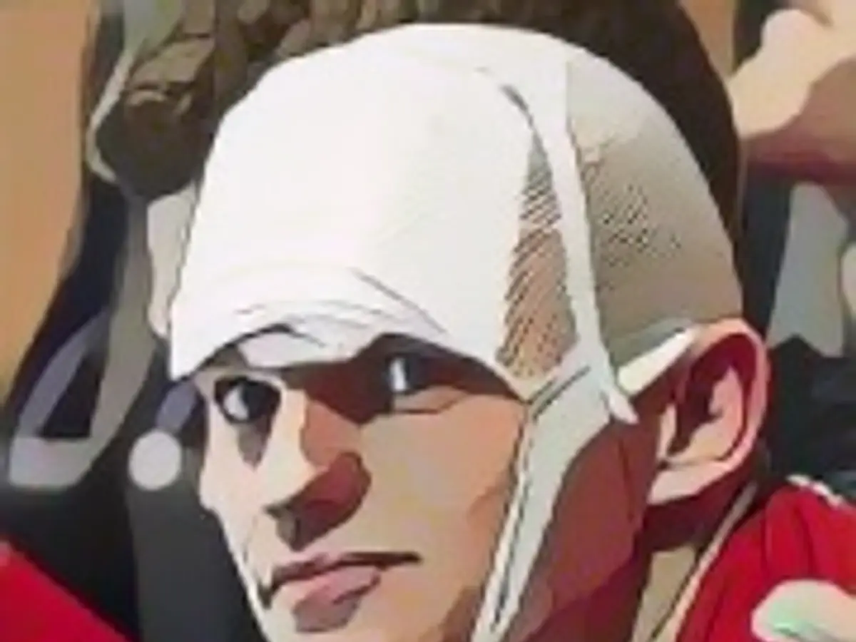 DHB star stitched up with six stitches