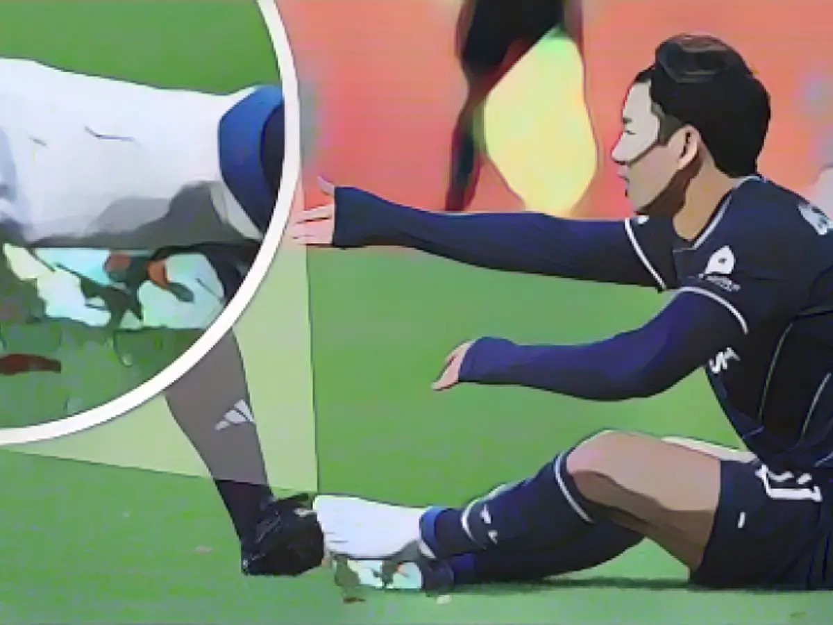 What is the Bochum star wearing here?