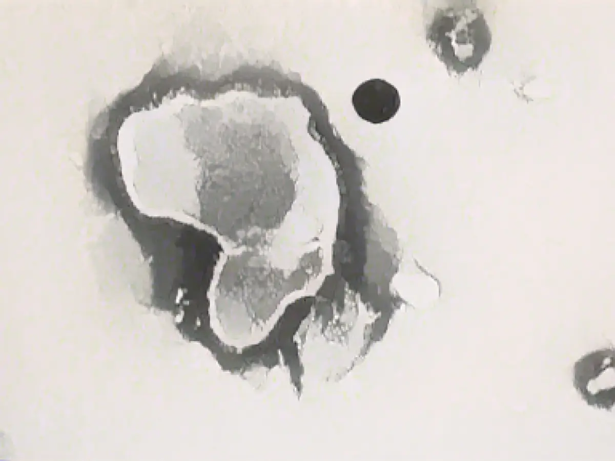 FDA approves first vaccine against RSV, 60 years in development